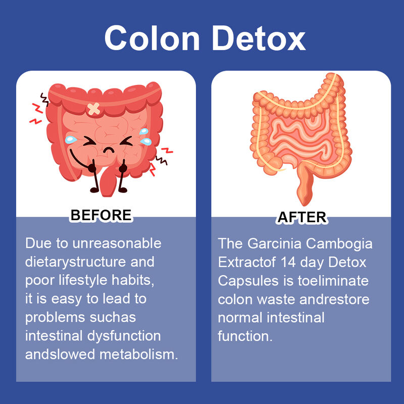 Частный бренд 14 дней Slim капсула поддерживает пищеварительное здоровье и потерю веса Диетическая добавка детокс капсулы